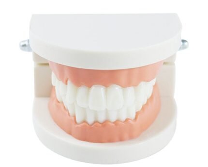 Teeth mold
